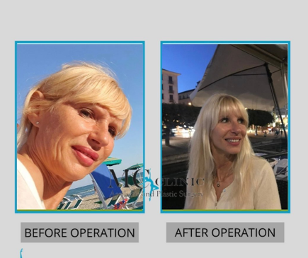 Slider image (7) MEHMET CEBER CLINIC